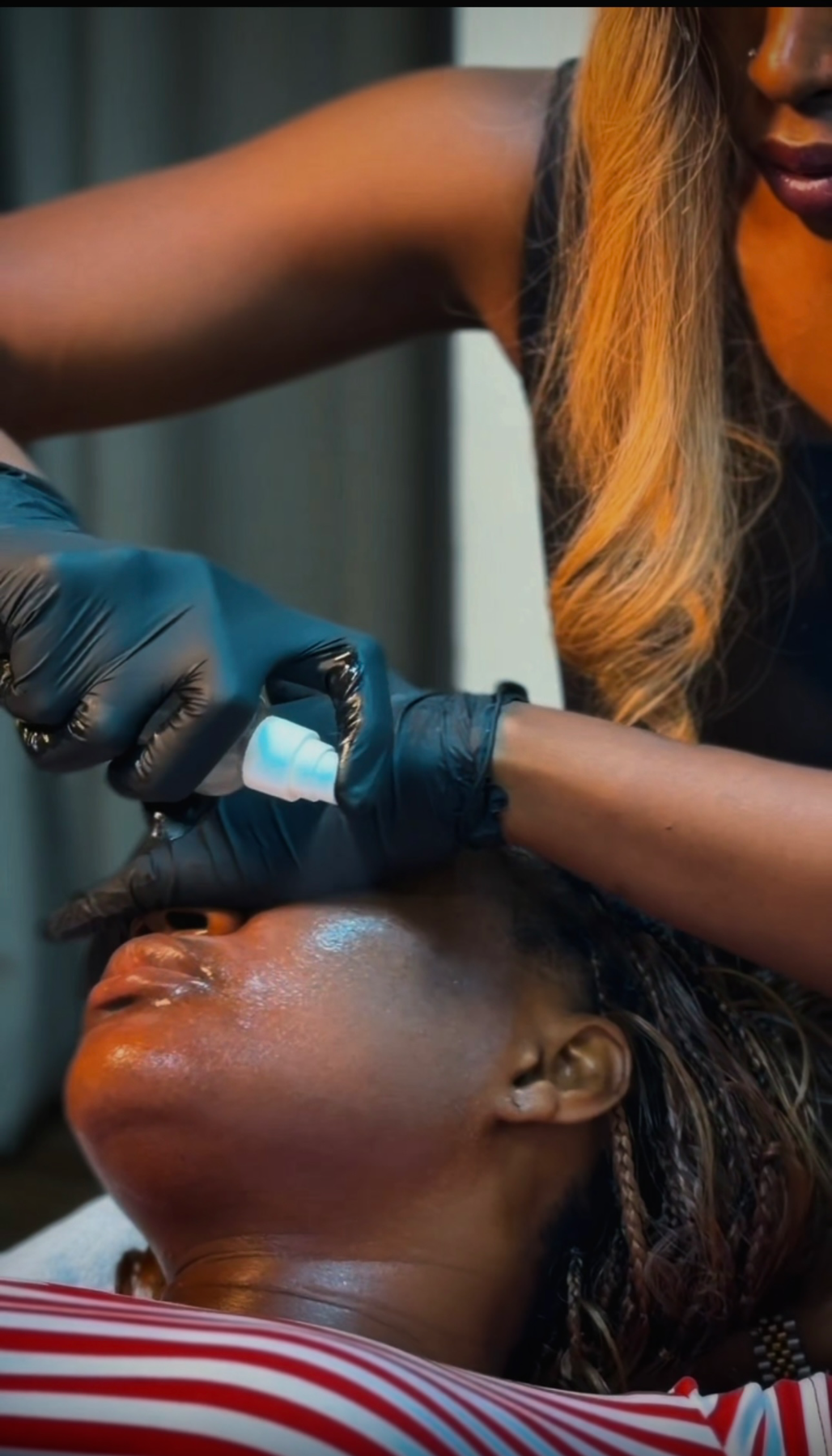 Chemical peels